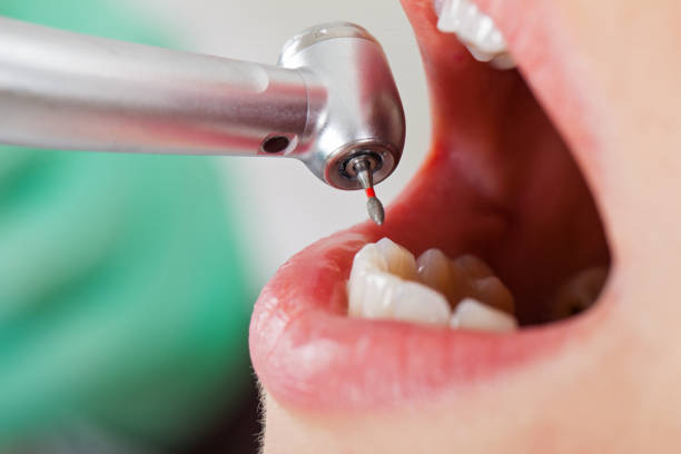 Best Knocked-Out Tooth Emergency  in Springfield, VA